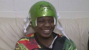 Trinity Hairston speaking out after surviving being shot in head