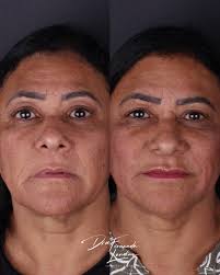 Dra. Fernanda Landim Cruz (@drafernandalandim) • Instagram फोटोहरू र  भिडियोहरू