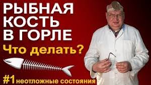 Rybnaya Kost Zastryala V Gorle Chto Delat Kak Pravilno Vytashit Rybnuyu Kost Youtube