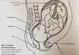 Ein kaiserschnitt ist trotzdem nicht zwangsläufig erforderlich. Ihr Kind Dreht Sich Wie Ein Brummkreisel In Ihrem Becken Besonderheiten Von Sternenguckern Und Was Es Zu Beachten Gilt Hypnobirthing By Mother Birth