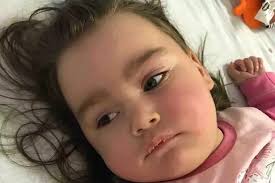 Mum of girl, 2, dying of dementia says illness is 'taking her daughter  piece by piece'