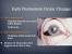 Eyes Of A Dying Person