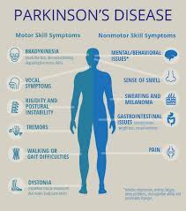 How do i know if i have parkinson's disease? Improving Life For Women With Parkinson S Disease Pcori