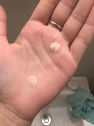 Feb 05, 2021 · if you don't wash your face before you go to sleep,. These 9 Acne Patches Are Quite Possibly The Most Satisfying Thing I Ve Ever Seen