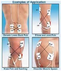 Pin On Electrostimulation