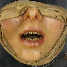 We did not find results for: Congenital Syphilis By E Kurschner Ziegfeld Moulage 260 12 Download Scientific Diagram