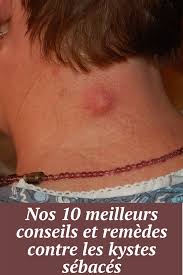 Epingle Sur Sante