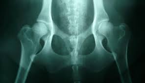One most common findings which leads to the suspicion of a dog cancer is the recurrence and incurability of symptoms, even if symptomatic treatment has been applied. Hip Dysplasia In Dogs Symptoms And Treatment