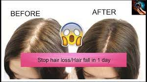 Protein is a must for healthy hair and one of the first tips to help stop your hair from falling out is to eat more protein, preferably from really good sources. How To Stop Hair Fall And Grow Hair Faster 3 Natural Hair Remedies To Try At Home Steemit