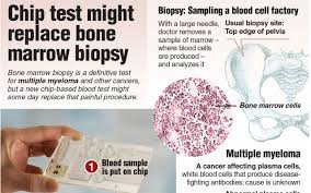 Whether your treatment is working. Did You Know Chip Test Might Replace Bone Marrow Biopsy Technation
