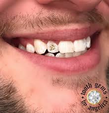 Want to know how to ease toothache at home? Tooth Gems Halo Tattoo Collective Tooth Gem Halo Tattoo Dental Jewelry