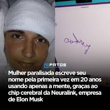 Após duas décadas sem conseguir se comunicar de forma autônoma, Audrey Crews,  uma mulher paralisada, escreveu seu nome usando apenas a mente. O feito  histórico foi possível graças ao chip cerebral da
