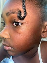 Allergy-friendly laundry detergent and soap suggestions