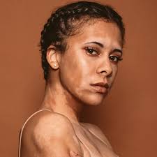 Bayou City Dermatology