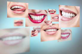 In white+ mode with leading. Healthy Smile Healthy Heart