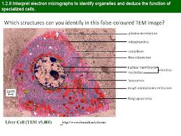 Figure 3.47 the cytoskeleton is a network of microfilaments, intermediate filaments, and microtubules found throughout the cytoplasm of a eukaryotic cell. The Ultrastructure Of Cells Topic 1 2 1