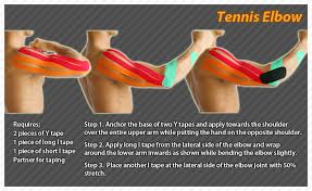 They recommended kinesio tape to me, and in combination with stretches and rehabilitation exercises i've used kt tape before, and it seems to work for me. Tennis Elbow Or Lateral Epicondylitis Is A Painful Condition Of The Elbow Caused By Overuse Not Surprisingly Pl Kinesiology Taping Tennis Elbow Kinesiology