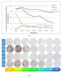 Prostate cancer, the second most common cancer diagnosed in american men other than skin cancer, is predicted to increase by an alarming 30% of new cases in 2021 along with a 2.4% increase in deaths from this disease. Cancers Free Full Text Age Related Biology Of Early Stage Operable Breast Cancer And Its Impact On Clinical Outcome