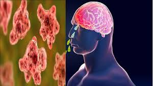 സംസ്ഥാനത്ത് ചികിത്സയിലിരിക്കെ മരിച്ച രണ്ടു പേർക്ക് കൂടി അമീബിക് മസ്തിഷ്ക ജ്വരം സ്ഥിരീകരിച്ചു