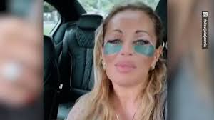 Ex-"Berlin Tag und Nacht"-Star: Julia Jasmin Rühle hatte eine  Augenlidstraffung