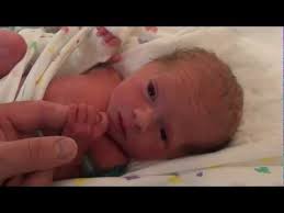 Emma Born At 33 Weeks Youtube Baby In Womb Preemie Babies Baby Gif