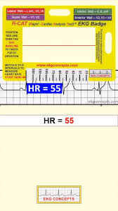 Image result for Electrocardiogram Validity