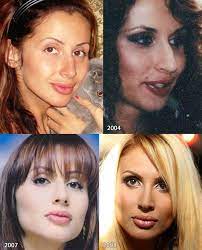 Check spelling or type a new query. Svetlana Loboda V Molodosti Kak Izmenilas Superzvezda Samye Slivki Yandeks Dzen