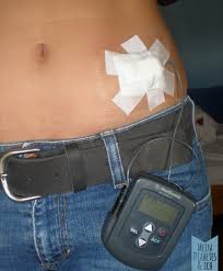 Wir Schreiben Das Jahr 2025 Mein Diabetes Ich