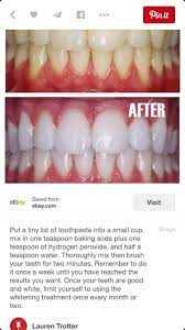 Pin On Home Remedies