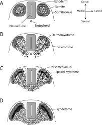 Maybe you would like to learn more about one of these? 6 Schematic Of Somite Differentiation A Newly Formed Somites Consist Download Scientific Diagram