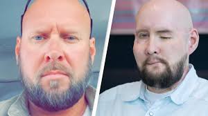 Boston surgeons successfully transplant a pig's kidney into a human