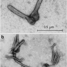 Check spelling or type a new query. A Comparison Of Isolated Marburg And Ebola Viruses By Negative Stain Download Scientific Diagram