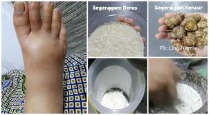 Check spelling or type a new query. Ini Petua Susutkan Bengkak Yang Mujarab Pantas Cubalah