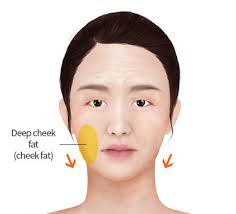 Oct 06, 2020 · how to lose cheek fat in one week the only real way to slim down your cheek fat in a week or less is to flush out the bloating and water weight. For Smooth And Slim Cheek Reduction Of Cheek Fat Jk Plastic Surgery