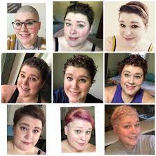Keep in mind that every patient is different so the percentages change. Hair Growth Progression Over 6 Months Hair