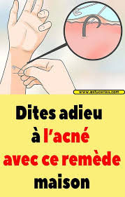 Dites Adieu A L Acne Avec Ce Remede Maison Acne Remede Bouton Acne