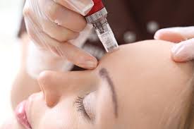 The peeling will be minimal, similar to a mild sunburn. What To Expect From Microneedling Skin Cancer Specialists P C Aesthetic Center