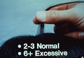 Image result for Hair Pull Test