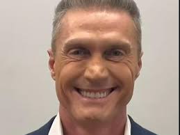 André Segatti revela harmonização facial no Fofocalizando. Veja como ficou! 