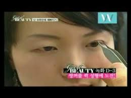 솔직히 많은 수술을 해야 많이 달라지겟지만. ì›ì§„ì„±í˜•ì™¸ê³¼ ê²Ÿìž‡ë·°í‹° Youtube