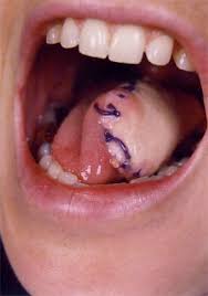 Resources For Dental Professionals Six Step Screening