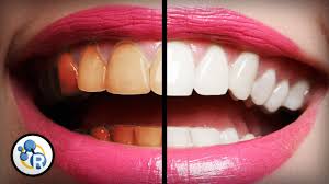 While many people aim for the sparkliest smile they can achieve, whiter teeth don't actually equal healthier teeth. What S The Best Way To Whiten Teeth Youtube