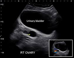 Pocus Gallery Renal Fellow Network