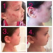 From the Avene Clinic to Dr. Aron