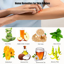 Clay is very helpful for itching and a number of other skin issues such as acne. Get Rid Of Rashes With 10 Simple Skin Rash Home Remedies