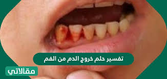 ما تفسير حلم غسل الصوف وتنظيفه في المنام؟ إن رؤية غسيل وتنظيف الصوف في المنام، فهو بشارة بالخير والرزق الوفير الذي سوف يحصل عليه الحالم، وإن رؤية غسل الصوف في المنام تدل على نظافة المال بالزكاة وعمل الخير للمحتاجين. ØªÙØ³ÙØ± Ø±Ø¤ÙØ© Ø§ÙÙØ±Ø¬ ÙÙ Ø§ÙÙÙØ§Ù ÙÙØ¹Ø²Ø¨Ø§Ø¡ ÙØ§ÙÙØªØ²ÙØ¬Ø© ÙÙØ§ÙØ§ØªÙ