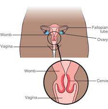 First symptoms of cervical most cancers forum masnews. Cervical Cancer Stages Stage 1 Stage 2 Stage 3 Stage 4 Macmillan Cancer Support
