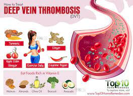 How To Deal With Deep Vein Thrombosis Dvt Top 10 Home Remedies Deep Vein Thrombosis Varicose Vein Remedy Vein Thrombosis