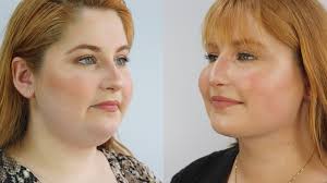 Social media celebrities (youtube)also the biography, life journey, wife, girlfriends, children of owhana, married: Clinica Fmr Clinica Fmr Owhana Lipoaspiracao Pescoco