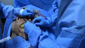 Pin On Intensive Surgical Skills Course Issc